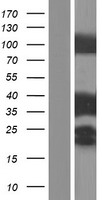 Tropomyosin 3 (TPM3) Human Over-expression Lysates NM_001043353