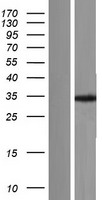 ls007171 tpm4 human over expression lysates nm 001145160 wb testing 1