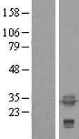 ls007171 tpm4 human over expression lysates nm 003290 wb testing 2