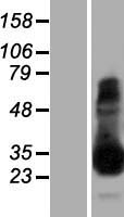 TPSAB1 Human Over-expression Lysates NM_003294