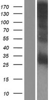 CRISP2 Human Over-expression Lysates NM_001142417