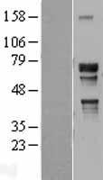 NR2C2 Human Over-expression Lysates NM_003298
