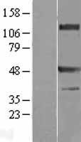 TRAF1 Human Over-expression Lysates NM_005658