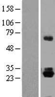 Thyrotropin Releasing Hormone (TRH) Human Over-expression Lysates NM_007117