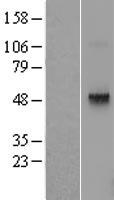 TRH Receptor (TRHR) Human Over-expression Lysates NM_003301