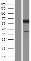 CCT3 Human Over-expression Lysates NM_001008800