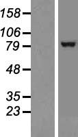 TRPC1 Human Over-expression Lysates NM_003304