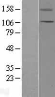 ls007224 trpc5 human over expression lysates nm 012471 wb testing 1