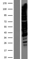 TRPS1 Human Over-expression Lysates NM_014112