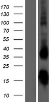 ls007252 tsh beta tshb human over expression lysates nm 000549 wb testing 1