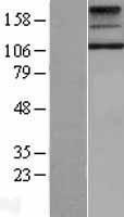 TSH Receptor (TSHR) Human Over-expression Lysates NM_000369
