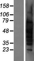 ls007258 tspy1 human over expression lysates nm 003308 wb testing 2