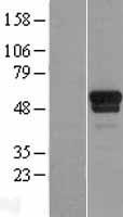 ls007259 tspyl1 human over expression lysates nm 003309 wb testing 1