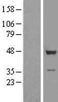 ls007260 eipr1 human over expression lysates nm 003310 wb testing 1