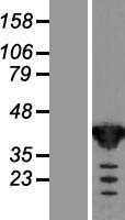 ls007264 gfus human over expression lysates nm 003313 wb testing 1
