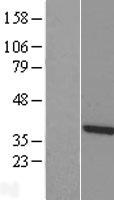ls007265 ttc1 human over expression lysates nm 003314 wb testing 1