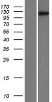 Transcription termination factor 1 (TTF1) Human Over-expression Lysates NM_007344