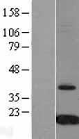 Prealbumin (TTR) Human Over-expression Lysates NM_000371