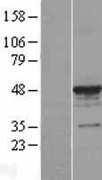 alpha Tubulin (TUBA3C) Human Over-expression Lysates NM_079836