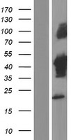 Tuftelin 1 (TUFT1) Human Over-expression Lysates NM_001126337