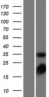 Thymidylate Synthase (TYMS) Human Over-expression Lysates NM_001071