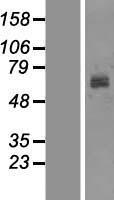 ls007299 tyrosinase tyr human over expression lysates nm 000372 wb testing 1