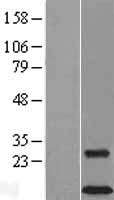DAP12 (TYROBP) Human Over-expression Lysates NM_003332