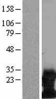 DAP12 (TYROBP) Human Over-expression Lysates NM_198125
