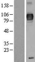 TRP1 (TYRP1) Human Over-expression Lysates NM_000550