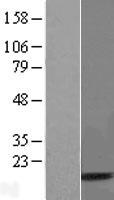 UBA52 Human Over-expression Lysates NM_001033930