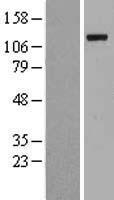 UBA1 Human Over-expression Lysates NM_003334