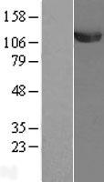 UBA1 Human Over-expression Lysates NM_153280