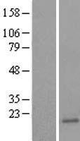 UBE2B Human Over-expression Lysates NM_003337