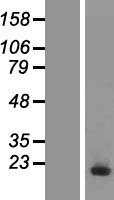UBE2D3 Human Over-expression Lysates NM_003340