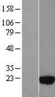 ls007323 ube2d3 human over expression lysates nm 181888 wb testing 4
