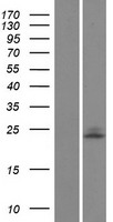 UBE2E1 Human Over-expression Lysates NM_182666