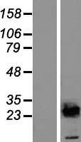 UBE2E2 Human Over-expression Lysates NM_152653