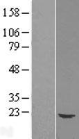 UBE2G1 Human Over-expression Lysates NM_003342