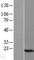 ls007327 ube2g2 human over expression lysates nm 003343 wb testing 1