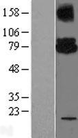 ls007327 ube2g2 human over expression lysates nm 182688 wb testing 2