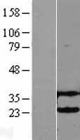 ls007328 ube2h human over expression lysates nm 003344 wb testing 1