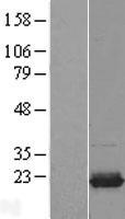 UBE2I Human Over-expression Lysates NM_194260