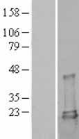 UBE2L3 Human Over-expression Lysates NM_003347