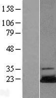 ls007334 ube2n human over expression lysates nm 003348 wb testing 1