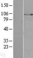 UBE3A Human Over-expression Lysates NM_000462