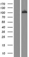 UBE3A Human Over-expression Lysates NM_130839