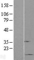 Sumo 1 (SUMO1) Human Over-expression Lysates NM_001005781