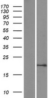 Sumo 1 (SUMO1) Human Over-expression Lysates NM_003352