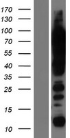 UBF1 (UBTF) Human Over-expression Lysates NM_001076684