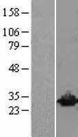 UCHL3 Human Over-expression Lysates NM_006002